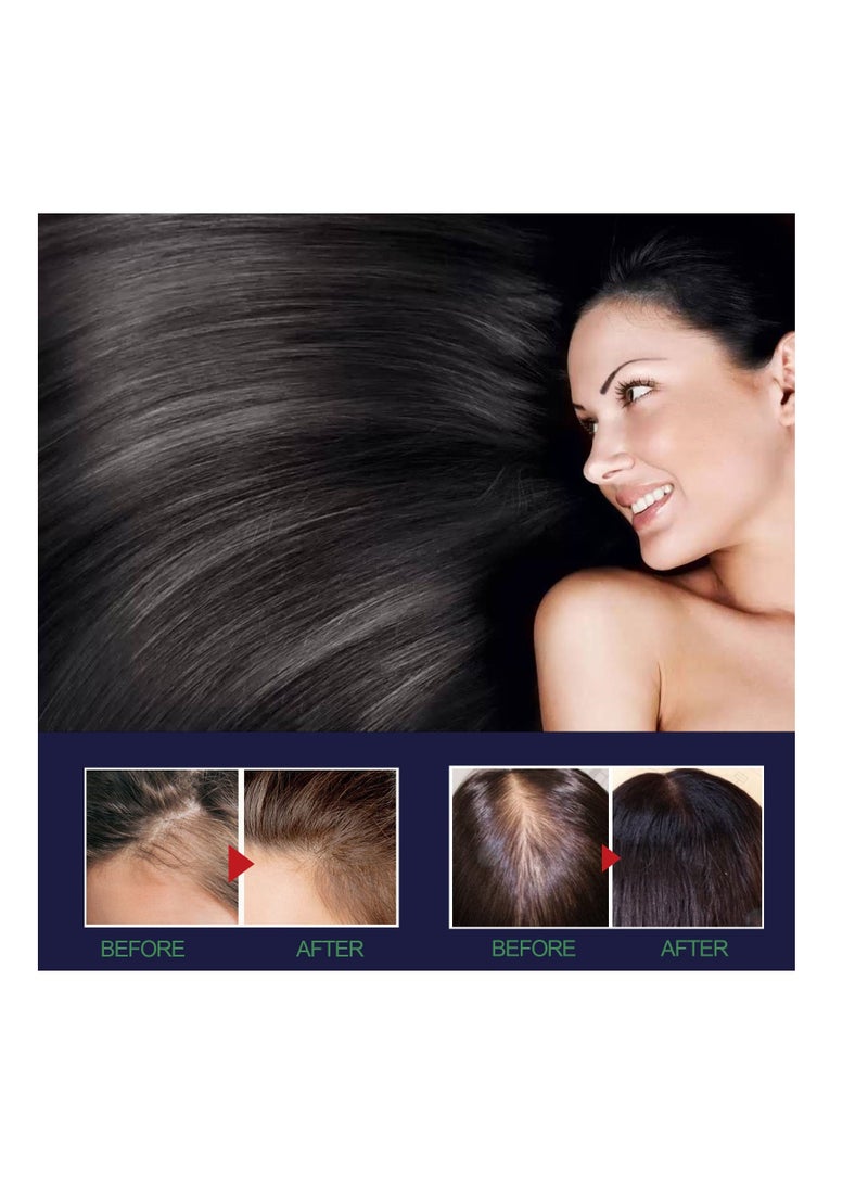 OUHOE Hair Growth Oil Damaged Hair Nourishing Hair growth - Image 3