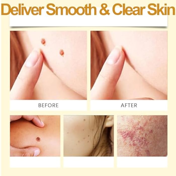 Zenbora Bee Venom Skin Restoration/Treatment Cream, Comprehensive Cream, Fast-Acting Reomver for Face & Neck & Body Blemishes, Painless & Natural Bee Venom Fits All Skin Types|0.71 Oz/20 G - Image 2