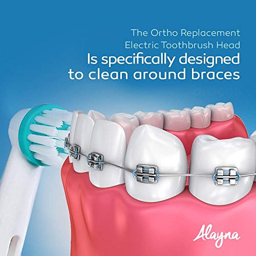 Alayna Ortho Replacement Brush Heads Compatible with Oral-B Electric Toothbrush – Power Tip Orthodontic Brush Heads for Braces & Dental Work, 20 Pack - Image 4