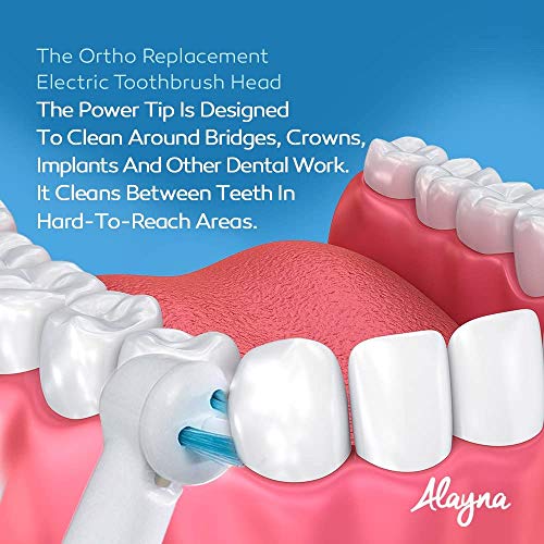 Alayna Ortho Replacement Brush Heads Compatible with Oral-B Electric Toothbrush – Power Tip Orthodontic Brush Heads for Braces & Dental Work, 20 Pack - Image 3