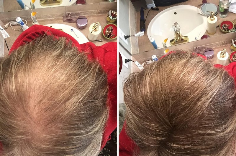 Caboki Hair Loss Concealer - Light Brown, 30g (1.06 oz) - Image 3