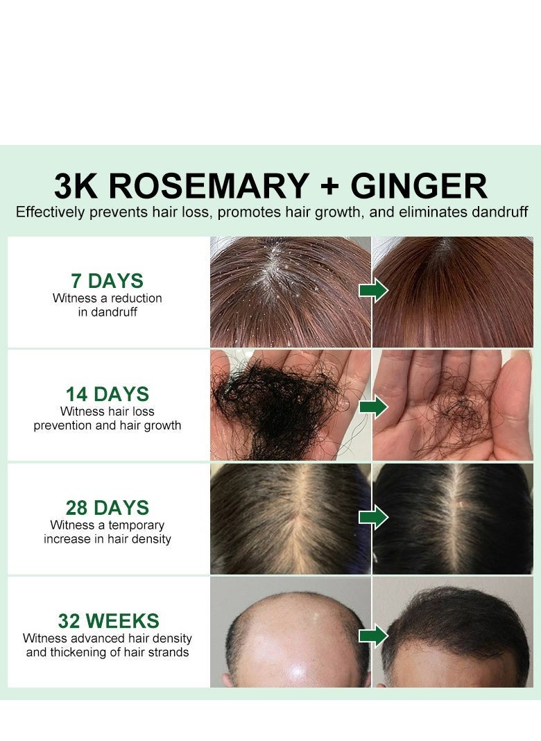 PURC Rosemary Hair Growth Oil, Nourishing Scalp Serum, Strengthening Treatment for Dry, Itchy Scalp, Promotes Thicker Hair for Men and Women (50ml) - Image 3