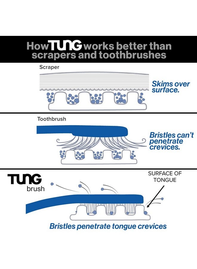 Peak Essentials The Original TUNG Brush Peak Essentials | The Original TUNG Brush Kits |Tongue Cleaner | Odor Eliminator | Fight Bad Breath | Fresh Mint | BPA Free | Made in America | (1 Count) - Image 5