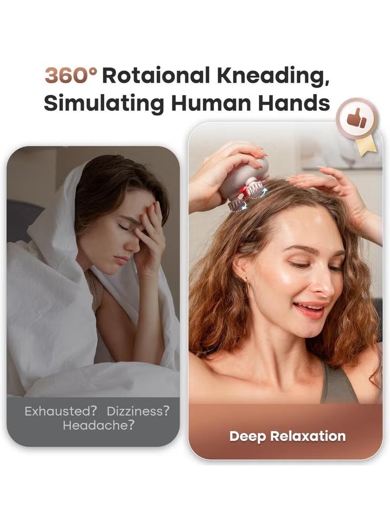 Ump Electric Scalp Massager, Portable Head Massager, Multifunctional Waterproof Head Massager, With 96 Kneading Nodes, Rechargeable Head Scratcher For Hair,  Growth Stress Relax Relaxing Gifts For Women Men Her - Image 2