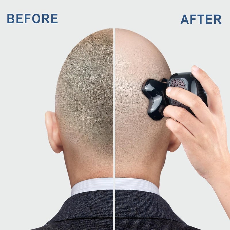 Telfun Upgrade Magnetic Head Shavers for Bald Men, Cordless & Comfort 5-in-1 Electric Razor - IPX7 Waterproof Wet/Dry Mens Grooming Kit - Easy Use Palm Shaver for a Smooth Bald Shave - Image 4