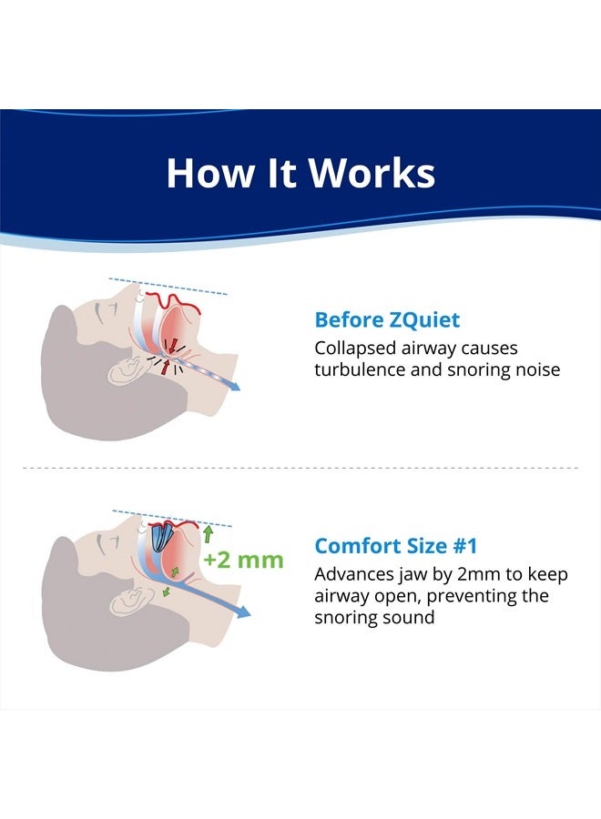 ZQuiet , Anti-Snoring Mouthpiece, Comfort Size #1, Single Refill, Blue, Made in USA, BPA-Free, Medical-Grade Material - Image 2