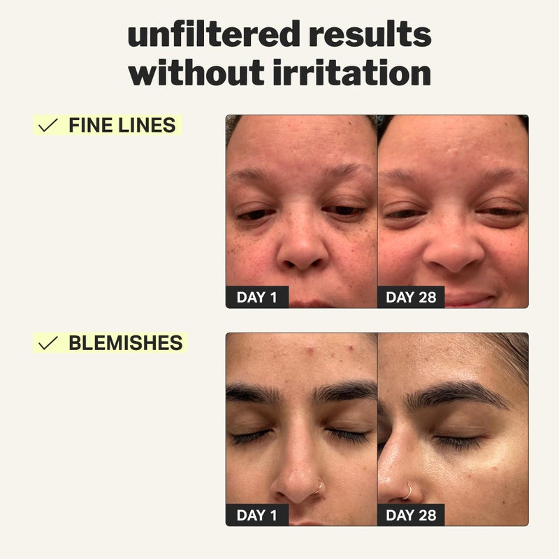 Cocokind Beginner Retinol Gel 0.1%, Improve the Appearance of Fine Lines and Uneven Texture without Irritation, Aloe and Cica to Prevent Dryness, 1 fl oz - Image 3