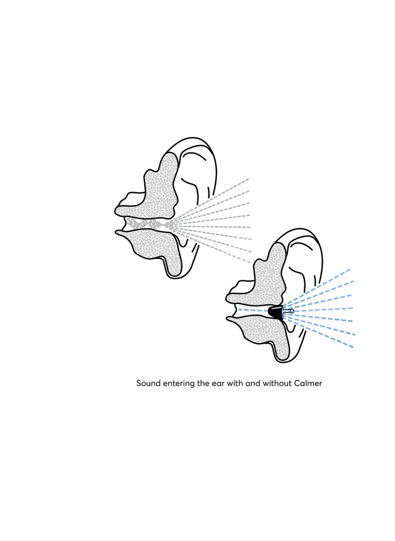 Audio Calmer Night - A Small In-Ear Device To Calm Sound Sensitivities, Reduce Stress And Take The Edge Off Unpleasant Noises During The Night (White)