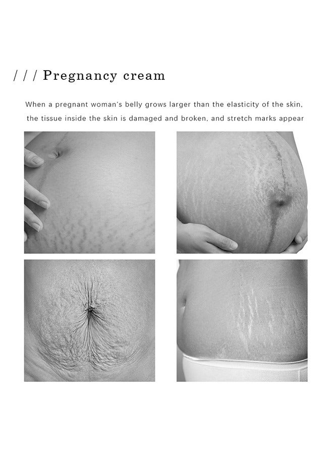 LIFUSHA Pregnancy Scars Cream - Stretch Marks Removal Cream Removes Stretch Marks Eliminate Pregnancy Scars Maternity Repair Anti-Winkle Anti-Aging Firming Skin Treatment Cream 40g - Image 3