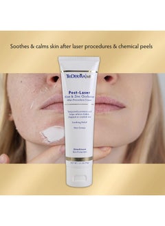 TriDerma TriDerma Post Laser Aloe & Zinc Occlusive Post Treatment Cream for Use After Chemical Peels, Micro-Needling or Laser Treatments 3.3 oz  - Image 3