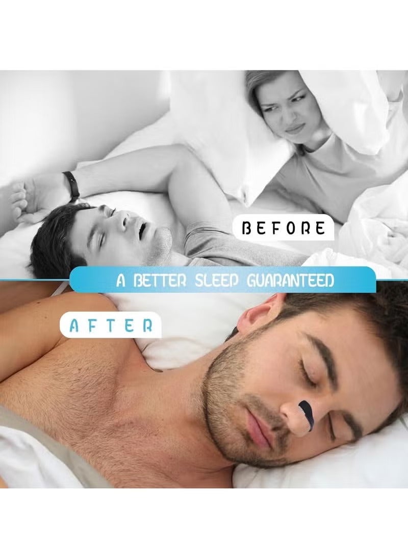 اترجسز التنفس الأنف التصحيح التمهيدي كيت 15 - زيادة كمية الأوكسجين ، والحد من الشخير ، وتحسين نوعية النوم - لا تحتوي على الأدوية أو المواد الكيميائية ، ومكافحة التعرق ، والجلد سلامة الأنف التصحيح ، قوس أسود - Image 2