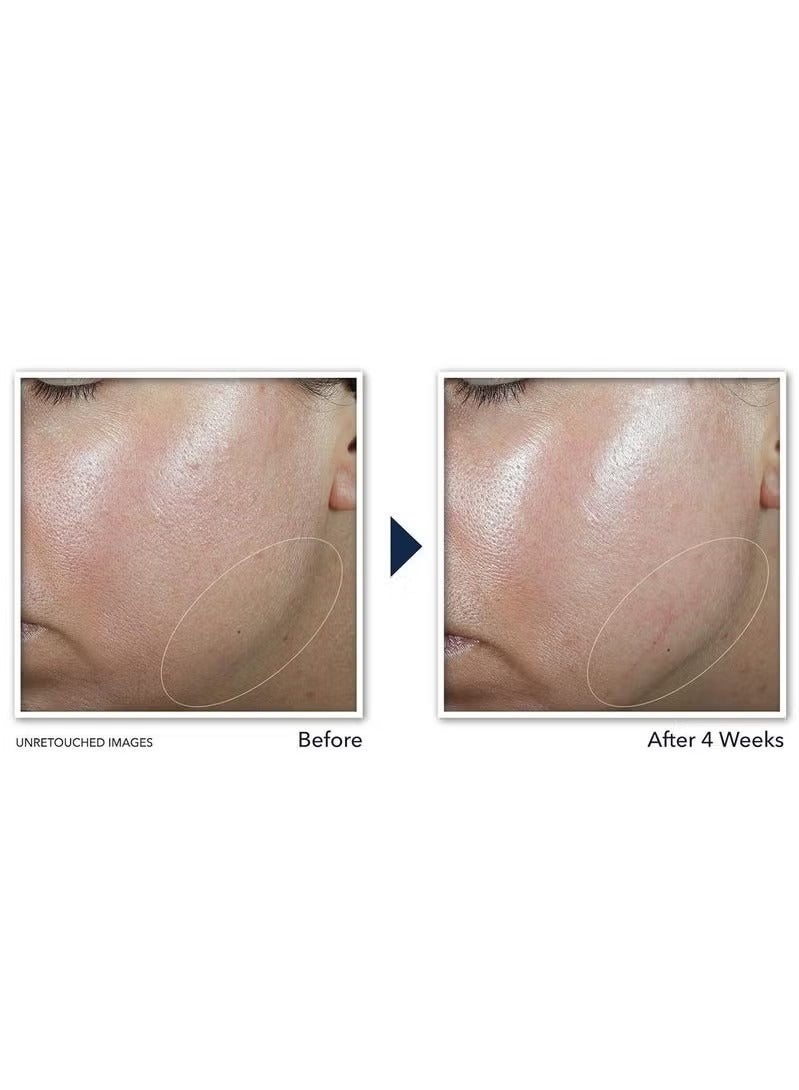 RoC Derm Correxion Neck Cream with Hyaluronic Acid and Advanced Retinol to visibly Tighten & Lift Horizontal Neck Lines, Facial Moisturiser to Contour Face, Neck + Jaw, (1.7 oz) - Image 4