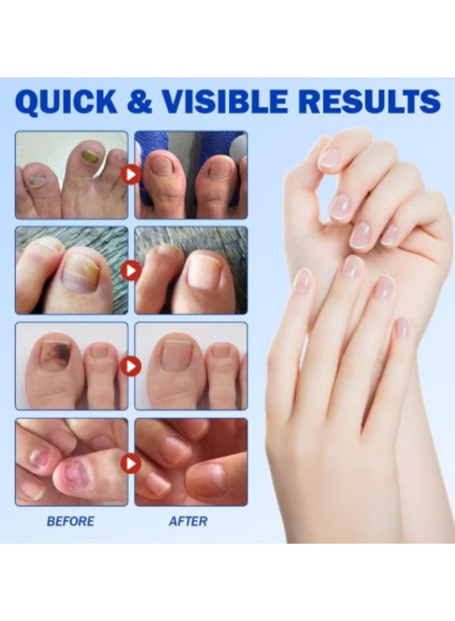 BOSART Fungal Nail Repair Patches – Effective Care Solution for Healthy, Strong Toenails. Easy-to-Use, Fast-Acting & Long-Lasting Results - Image 3