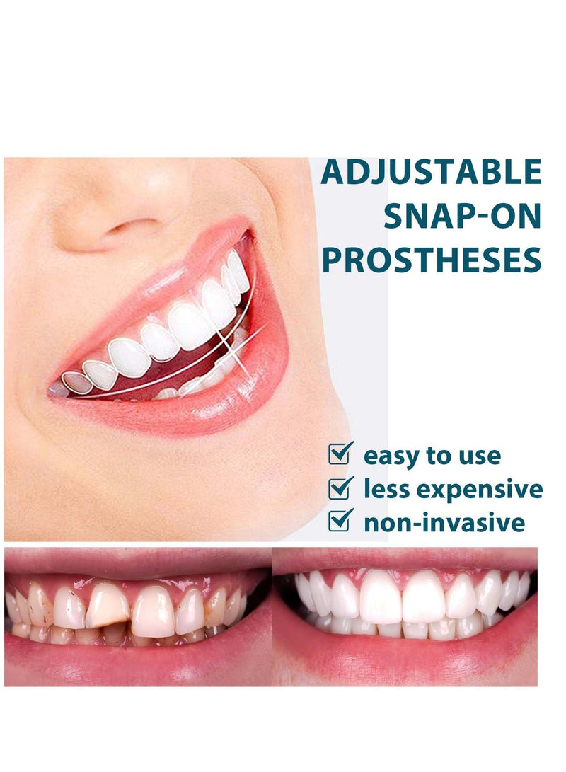 إيلهو طقم إصلاح الأسنان، أطقم أسنان قابلة للتعديل، قوالب أطقم أسنان مؤقتة قابلة للتخصيص لاستعادة ابتسامة واثقة - Image 4