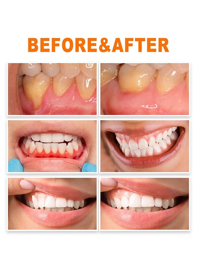 EELHOE Gum Repair Essence Ampoules,Ampoule Tooth Serum, Deep Cleaning & Gum Repair Toothpaste, Fresh Breath, Natural Ingredients, 1.5ml * 7Pcs - Image 4