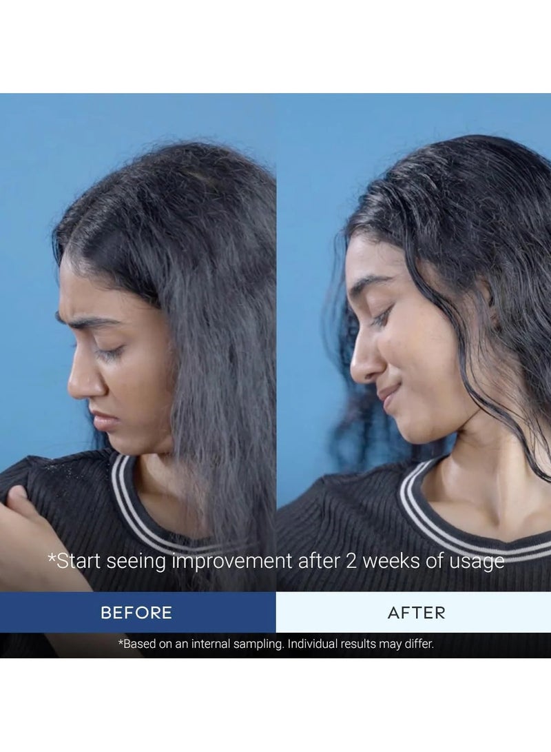 Arata Anti Dandruff Shampoo For Normal To Oily Hair (200 Ml) - Image 5