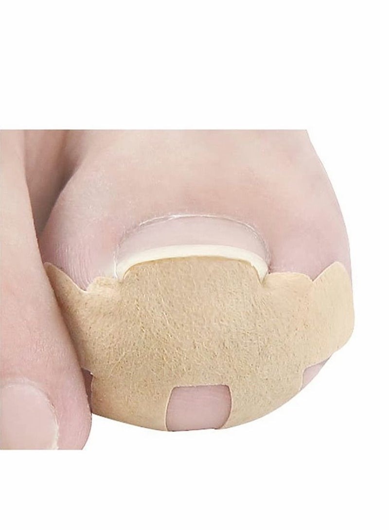 ملصقات تصحيح أظافر القدم الغارزة، شرائط مصحح أظافر القدم الغارزة خالية من الغراء، رقعة مصحح أظافر القدم غير المؤلمة، أداة احترافية لعلاج أظافر القدم (60 قطعة) - Image 2