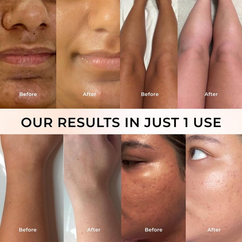 Niconi NICONI GlutaKojic Skin Polish Instant Tan Removal Glowing Skin Infused with Kojic Acid Glutathione Ideal for All Skin Types Lightens Suntan 180g  - Image 5