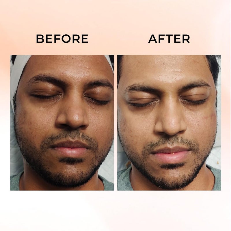 Niconi NICONI GlutaKojic Skin Polish Instant Tan Removal Glowing Skin Infused with Kojic Acid Glutathione Ideal for All Skin Types Lightens Suntan 180g  - Image 4