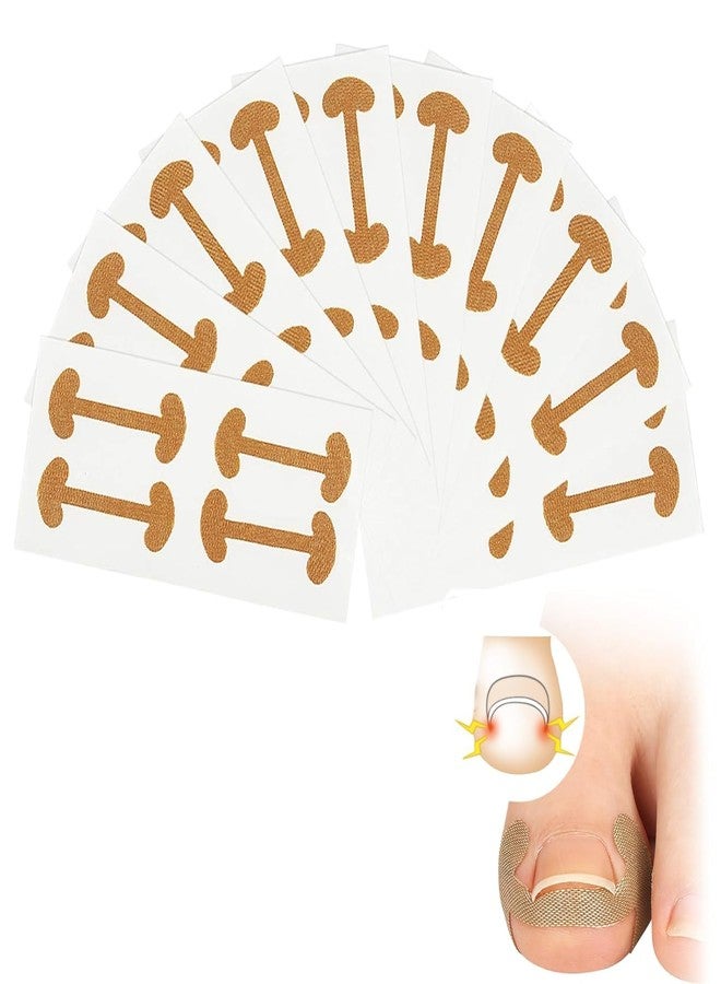 Rexez Pack of 10 Toenail Correction Patches, Ingrown Toenails, Nail Correction Clip, Patch Toenail, Toenail Plaster for Treating Ingrown Toenail - Image 2