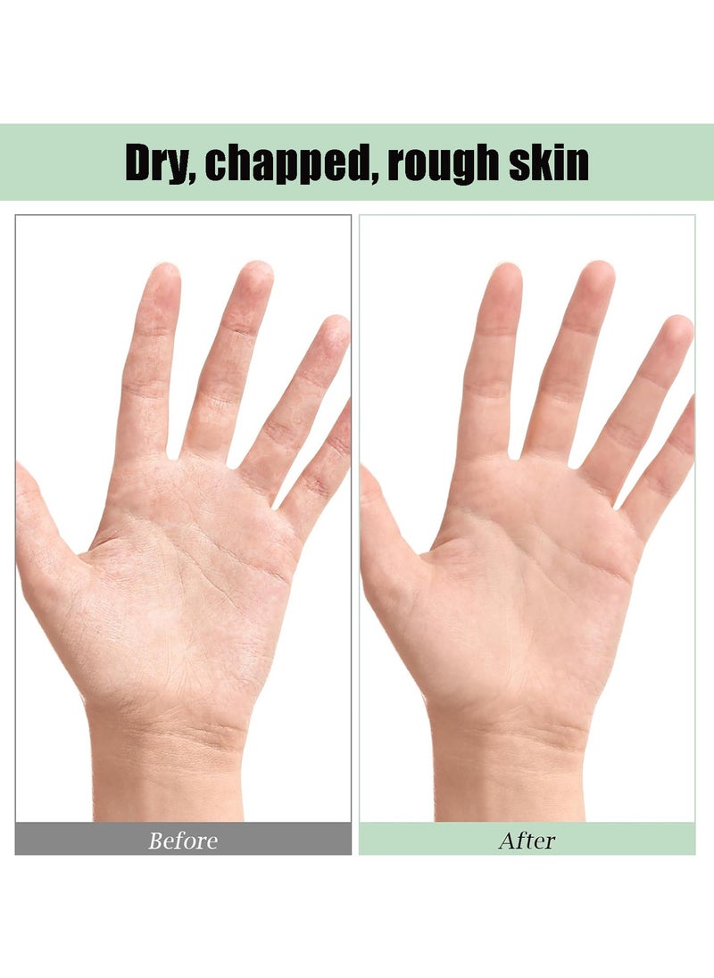 CMGTYYD Sterilized Gloves, Gel Spa Sterilization Therapy Socks and Gloves Hand Masks Sterilized Gloves Gel Gloves Dry Hands Softening Repair Dry Cracked Hands and Feet Skin Care  - Image 5