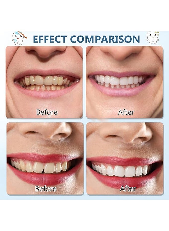 Generic Teeth Veneers White Dentures for Upper and Lower for Women Men Comfortable Flex Cosmetic Teeth Comfortable and No Pain Regain Confident Smile  - Image 5