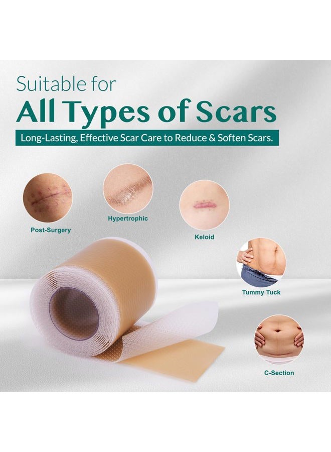 Arlun Silicone Scar Tape, Silicone Scar Sheets, Scar Tape for Surgical Scars, Silicone Tape for Scars, Scar Sheets for Surgical Scars, C-Section, Tummy Tuck and Keloid (1.6"x 60" Roll-1.5M) - Image 3