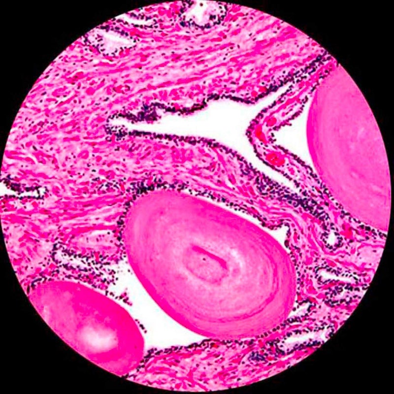 AmScope مجموعة شرائح المجهر المحضرة PS100B للتعليم الأساسي في العلوم البيولوجية، 100 شريحة، المجموعة ب، تشمل علبة خشبية مصممة - Image 4