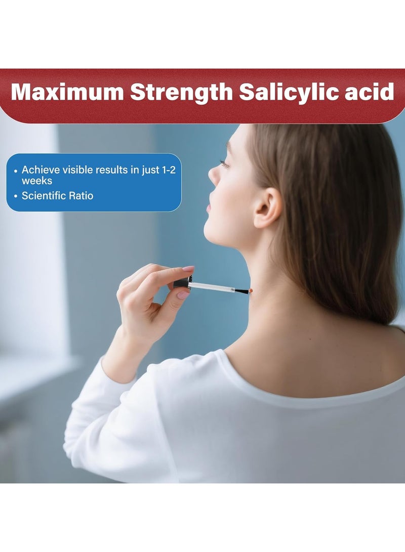 جوودنايتس Fast-acting Skin Tag Removal Kit, Natural and Gentle Salicylic Acid Formula, Zero Pain Skin Tag Remover, Suitable for Neck, Underarms, Groin, Trusted by the Whole Family - Image 2