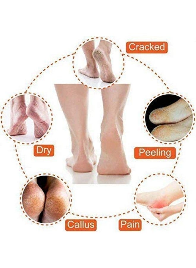 SmarkLabs SmarkLabs-Silicone Gel Heel Pad Socks for Heel Swelling Pain Relief,Dry Hard Cracked Heels Repair Cream Foot Care Ankle Support Cushion - for Men and Women - Image 3