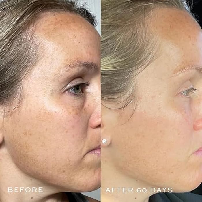 DIME Beauty TBT Serum - Anti-Aging Face Serum With Niacinamide and Mandelic Acid, Hydrating for Youthful Skin, 1 oz (30 mL) - Image 3