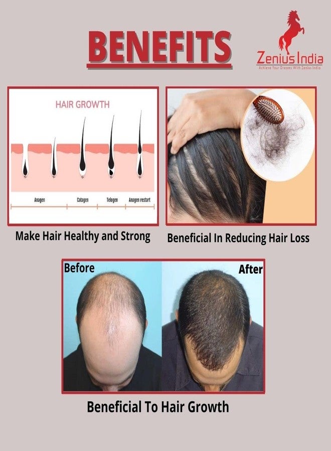 Zenius India زيت للشعر للرجال والنساء، مضاد لقشرة الرأس، تساقط الشعر، جفاف الشعر وتجعده، فقدان الشعر، عناية فائقة بالشعر بفوائد النيم، الصبار، الأملا، اللوز، والبرينجراج. - Image 4