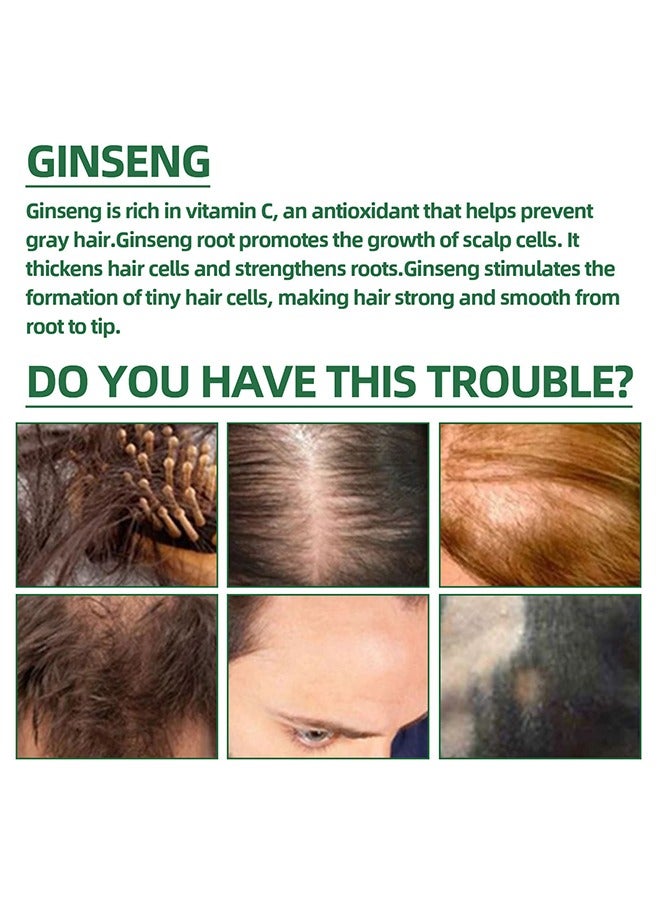 أوهو أعشاب طبيعية ، بخاخ نمو الشعر ، محلول نمو الشعر الجينسنغ ، مستخلص الجينسنغ مرطب للشعر مضاد لتساقط الشعر بلسم لنمو الشعر بخاخ نمو الشعر 100 مل - Image 4