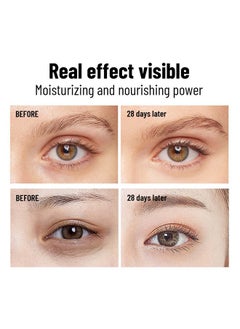 OUKEYA OUKEYA 2 Pcs Eye Cream for Dark Circles, Under Eye Cream Anti Aging Wrinkles, Eye Cream for Puffiness & Bags Under Eyes, Dark Circles Under Eye Treatment with Massage Roller  - Image 5