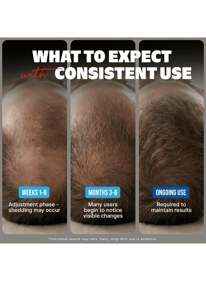 والبك Walpck MINOXIDIL الرجال والنساء نمو الشعر ، نمو اللحية ، علاج تساقط الشعر ، الكبار من نوع واحد ، رغوة غير معطرة ، 3Fl أوز ، 2Bottles - Image 4