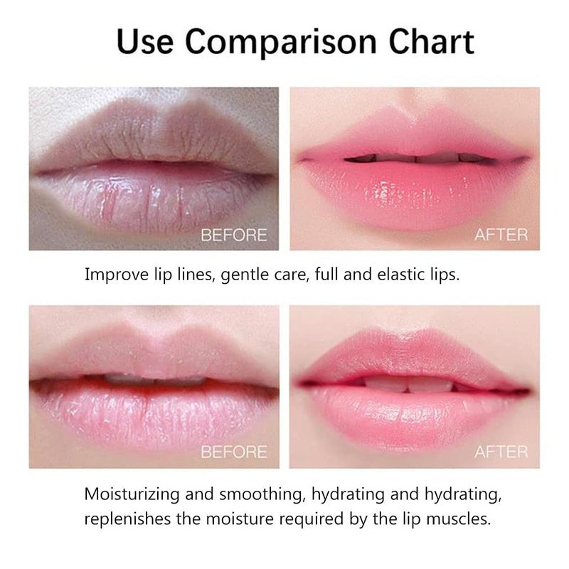 Miniling 20Pcs Moisturizing/Plumping Lip Mask, Restores Moisture Mask for Dry Lips and Lines Overnight Care, Gel Treatment Masks â€‹ (Pink) - Image 3