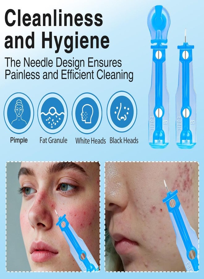 Xiuouix 60PCS Pimple Popper Kit with 72 Acne Patches, Disposable Blemish Tool for Whitehead, Blackhead, Pimple Clearing, Ultra-Fine 0.3mm Tip for Home/Travel Use (Blue) - Image 3