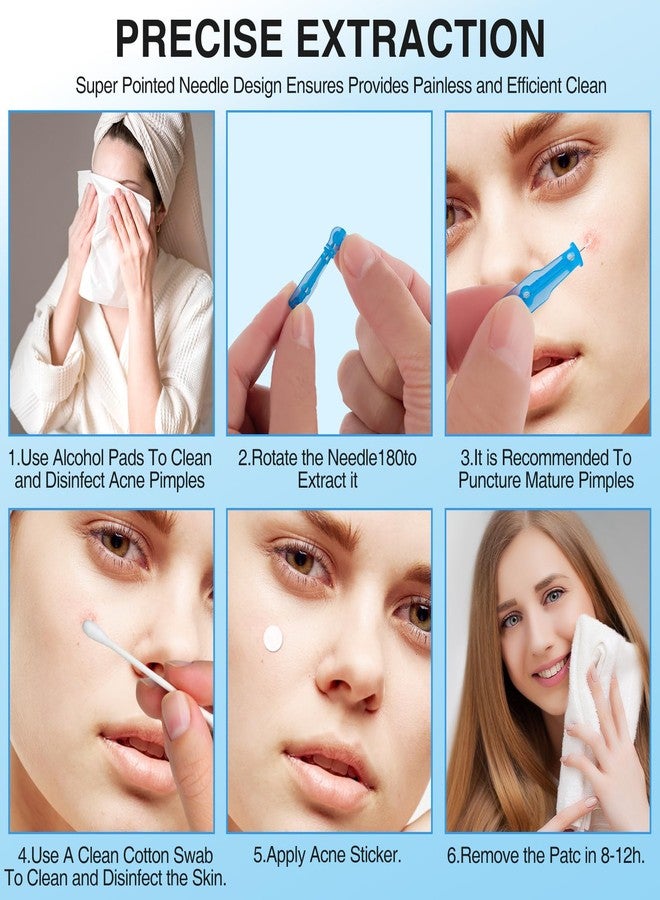 Xiuouix 60PCS Pimple Popper Kit with 72 Acne Patches, Disposable Blemish Tool for Whitehead, Blackhead, Pimple Clearing, Ultra-Fine 0.3mm Tip for Home/Travel Use (Blue) - Image 5