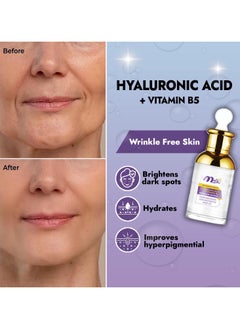 Malika Hyaluronic Acid 2% + Vitamin B5 Serum 30ml - pzsku/Z1D1AC8BAD0959A23D607Z/45/_/1739636259/499f698b-822c-4006-99eb-6dcd96b5e109