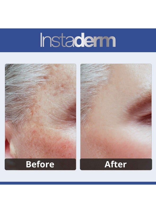 إنستاديرم كريم مصحح البقع الداكنة المضاد للشيخوخة يتلاشى بشكل طبيعي البقع الداكنة وبقع الشمس والبقع العمرية وندبات حب الشباب والبقع البنية والنمش للحصول على بشرة أكثر إشراقًا ورطبة. - Image 3