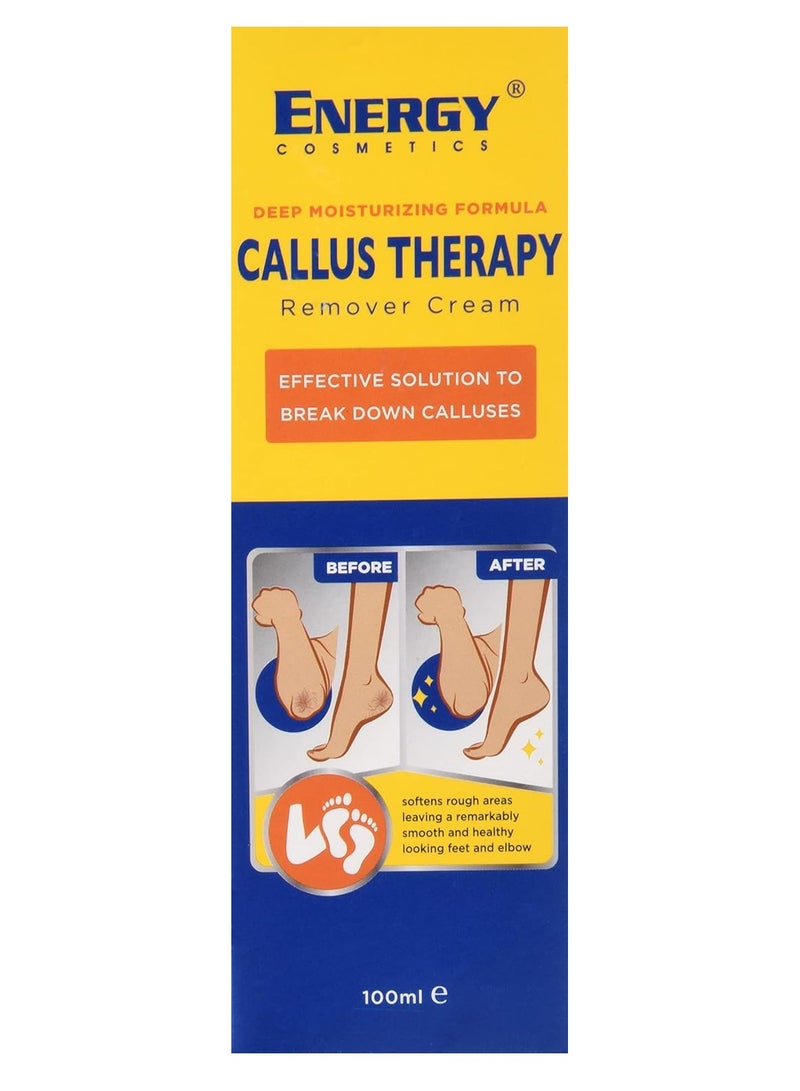 إينرجي انرجي كوزمتكس كريم ازالة الجلد من القدمين 100 مل - Image 1