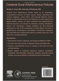 Cerebral Dural Arteriovenous Fistulas - pzsku/Z1D23E85790976D1B0670Z/45/_/1740733290/678f2314-d3b2-4dfc-92d7-d147b23b4eb5