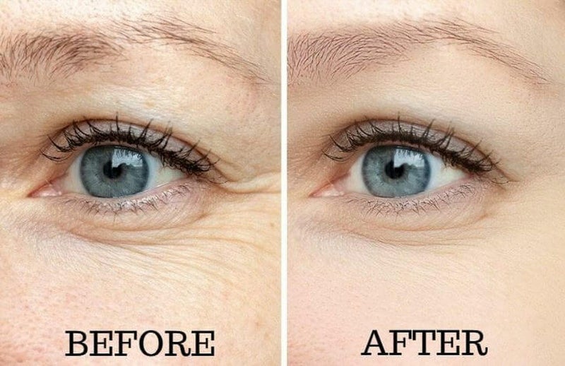 Osmotics Cosmeceuticals Osmotics Under Eye Rejuvenator, Anti Aging Eye Cream For Dark Circles, Eye Bags, Fine Lines, Puffiness. Best Anti Aging Eye Cream for Wrinkles, Crows feet, And Puffy Eyes - Image 4