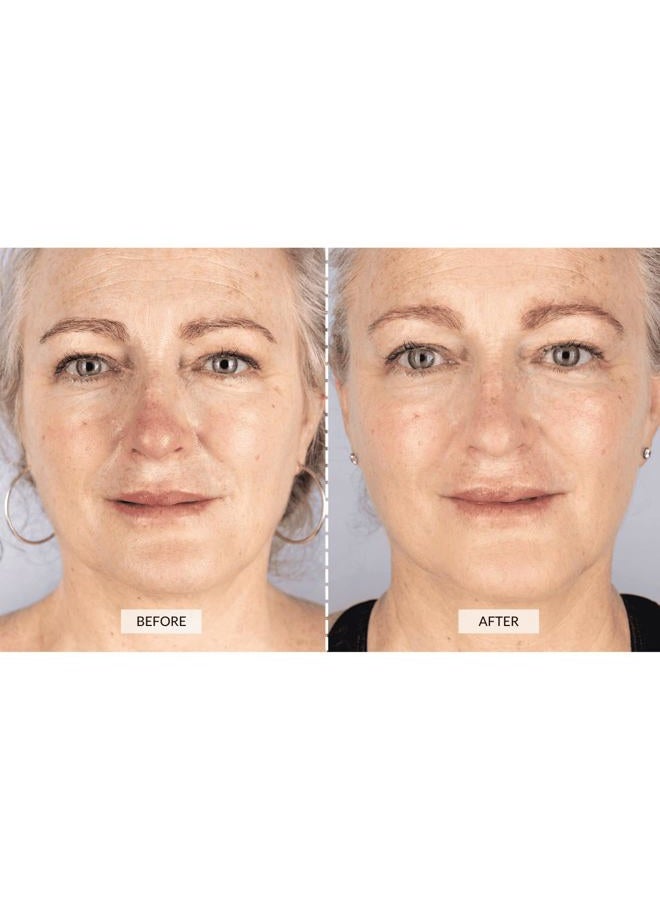 CurrentBody Skin LED Light Therapy Face Mask | Red Light Therapy Treatment Device | Anti-Aging Face Mask for Wrinkle Reduction - Image 3
