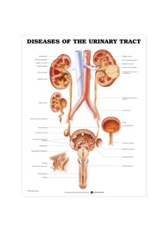 ACC Diseases of the Urinary Tract Anatomical Chart  - Image 1