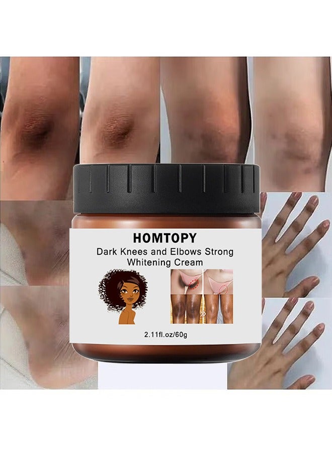 HOMTOPY Dark Knees And Elbows Strong Whitening Cream, 60G Get Rid Of Knuckles Easily In Just 7 Days Skin Whitening Improve Skin Tone Nourishing And Moisturizing Cream  - Image 1