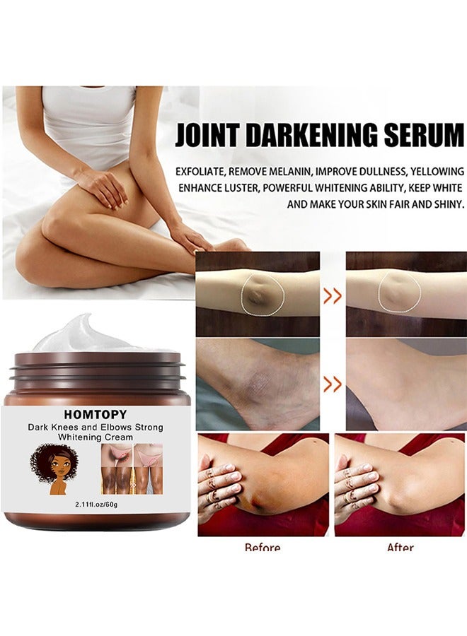 HOMTOPY Dark Knees And Elbows Strong Whitening Cream, 60G Get Rid Of Knuckles Easily In Just 7 Days Skin Whitening Improve Skin Tone Nourishing And Moisturizing Cream  - Image 3