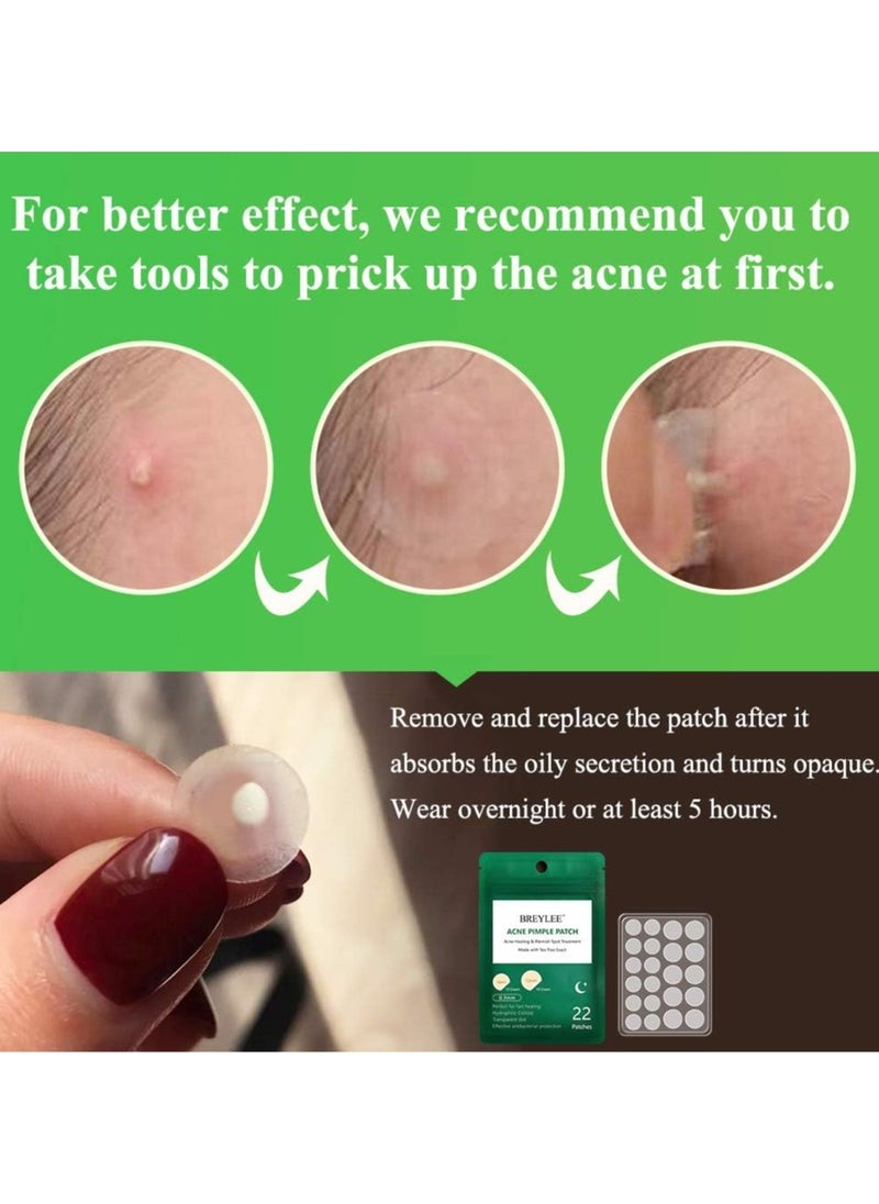 Acne Pimple Patch Acne Healing and Blemish Spot Treatment Clear