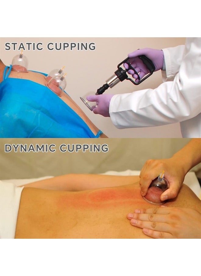Cupping Therapy Set, 24 Massage Cups Cupping Set with Pump Vacuum Suction Cups for Body Cellulite Cupping Massage Back Pain Relief, Chinese Acupoint Physical Cupping Therapy Hijama