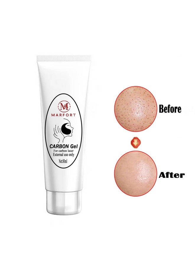 Marfort Carbon Peel Cream Gel For Facial Skin Rejuvenation Black Doll Deep Cleaning With Carbon Gel Safe & Effective（80Ml） - Image 4